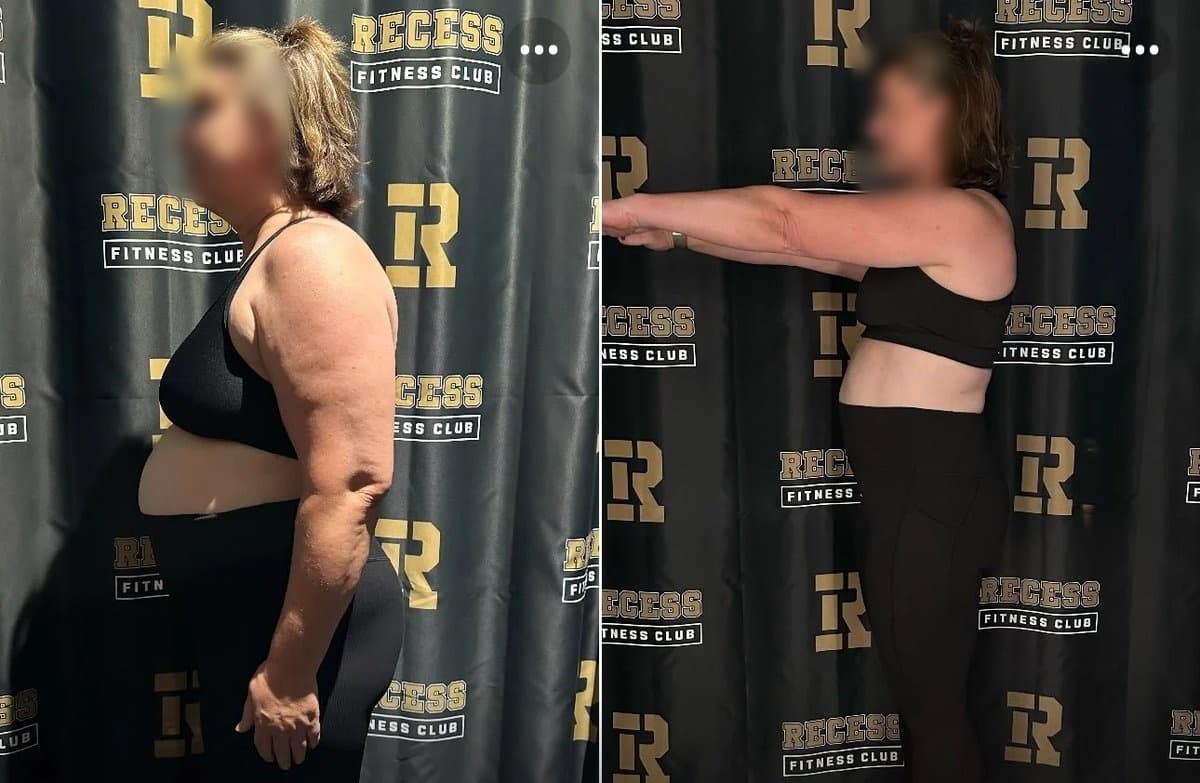 Patient transformation